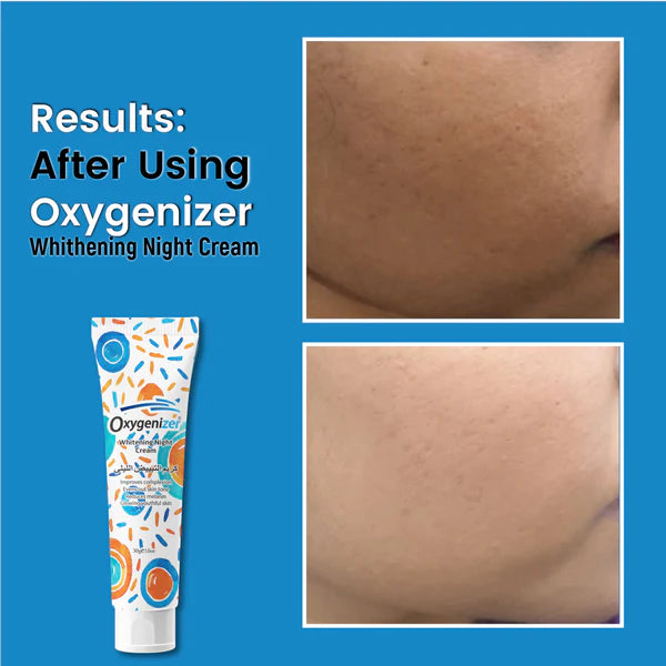 Cream For Skin Whitening – Oxygenizer