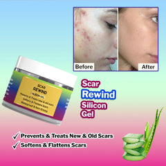 Scar Rewind Silicone Gel